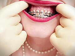 ASMR-video, jossa söpö MILF lateksikäsineissä ja hammasraudatessa kuuntelee potilaan lelua